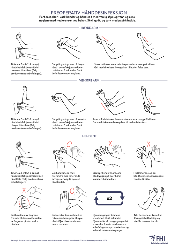 illustrasjon over preoperativ hånddesinfeksjon